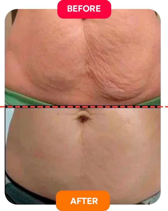 3. It Reduces Measurements — Not Just Skin Appearance